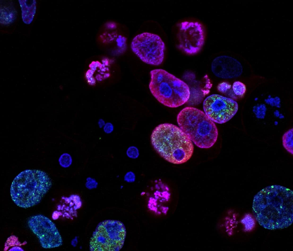 Fluorescence microscopy of human cells — the living biology behind our tissue engineering platform